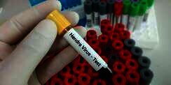 Heboh Kemunculan Virus Hendra di Australia, Begini Penularannya