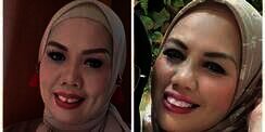 Potret Dulu dan Sekarang Elly Sugigi, Sempat Diduga Oplas Kini Penampilannya Bikin Pangling!