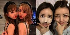 10 Potret Si Kembar yang Oplas Demi Terlihat Identik, Netizen Salfok Foto Before-nya: Beda Banget!