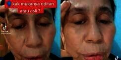 Idap Penyakit Langka, Wajah Wanita 28 Tahun Ini Berubah Seperti Wanita Usia 60 Tahunan