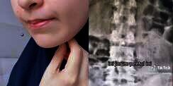 Buang Kebiasaan 'Pegang' Jarum Pentul Pakai Bibir Saat Pakai Hijab, Dampaknya Bisa Mengancam Nyawa