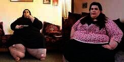 Pernah Berbobot 317 Kg dan Diagnosis hanya Hidup sampai Umur 30 Tahun, Penampilan Terbaru Wanita Ini Setelah Diet Bikin Melongo