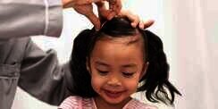 Aksesori Rambut Bisa Bahayakan Anak, Simak Penjelasan Dokter