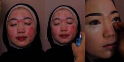 Transformasi Makeup Wajah Berjerawat Parah Jadi Natural dan Flawless