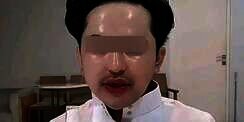 Kulit Wajah Pria Ini Kelewat Glowing Seperti Dilaminating