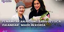 Penampakan Hidung Baru Jessica Iskandar 