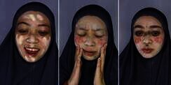 Transformasi Wajah Cewek Mirip Badut Jadi Cantik Glowing, Sampai Dikira Beda Orang
