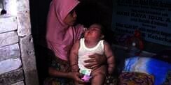 Setelah Fajri Tangerang, Bayi di Bekasi Alami Obesitas, Umur 7 Bulan Bobotnya 15,5 Kg