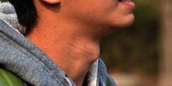 Apakah Wanita Juga Memiliki Jakun? Ini Penjelasannya