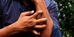 Kenapa Menggaruk Terasa Begitu Nikmat hingga Sulit Ditahan