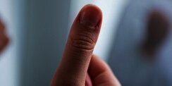 Kuku Tiba-Tiba Memerah? Perubahan Kecil Ini Bisa Jadi Tanda Penyakit Tersembunyi