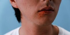 Penyakit Ini Bisa Bersembunyi di Tubuh Selama Bertahun-tahun dan Menyebabkan Nyeri Hebat, Kenali Gejalanya