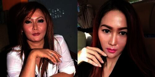perubahan wajah Inul Daratista
