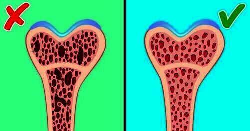 6 Cara Menghindari Osteoporosis