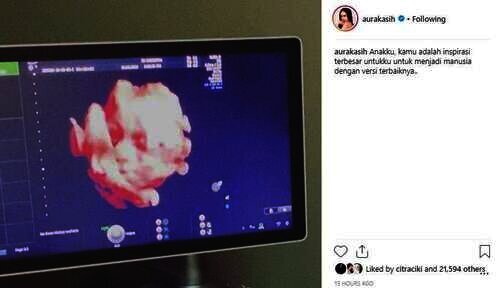 Aura Kasih