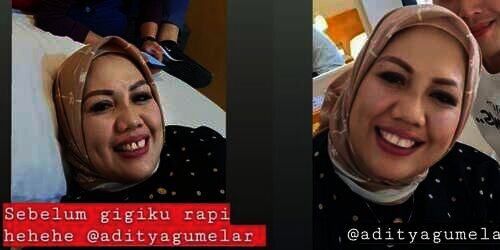 Penampilan Elly Sugigi