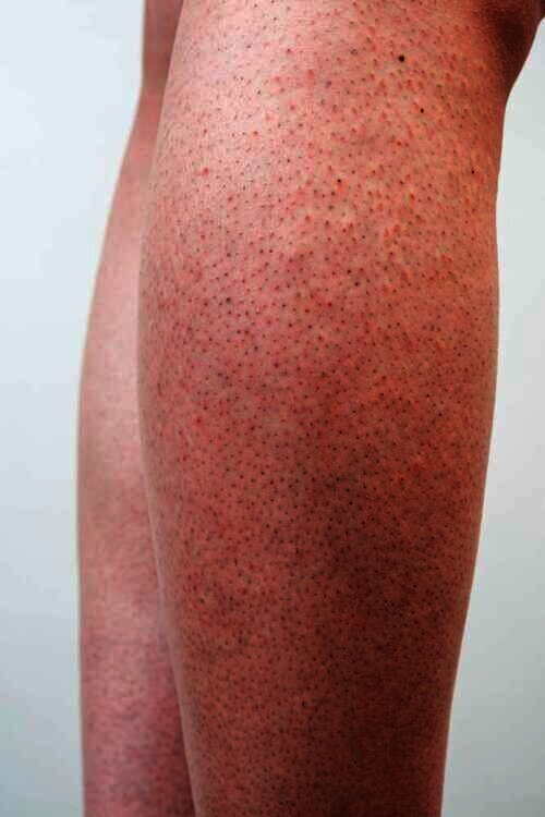 Ilustrasi strawberry legs