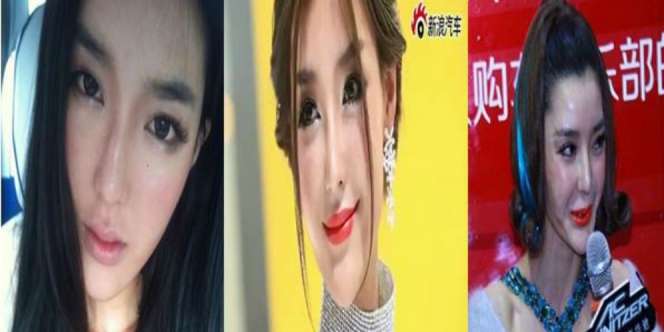 Operasi Plastik Kedaluwarsa Ubah Model Cantik Jadi Mengerikan