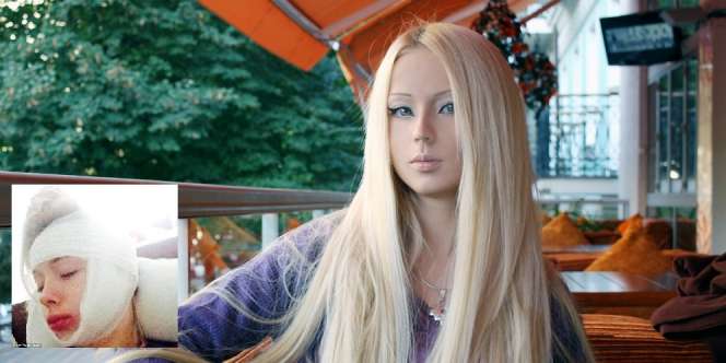 Jurnalis: Si Cantik 'Manusia Barbie' Ternyata Alien Rasis