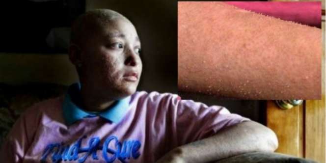 Di Tubuh Wanita Ini Tumbuh Kuku