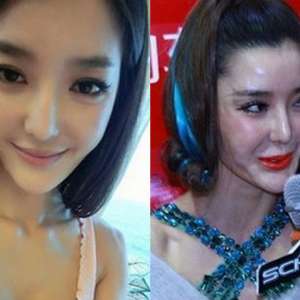 Para Artis Cantik Ini Pernah Dituding Operasi Plastik