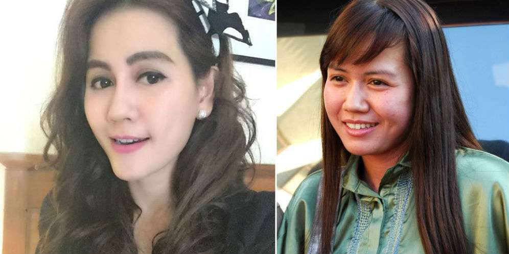 Heboh Pedangdut Nita Thalia Operasi Plastik