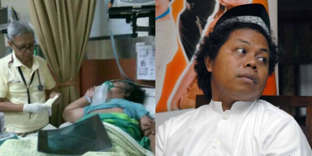 Budi Anduk Kritis, Idap Kanker Paru-Paru Stadium 4