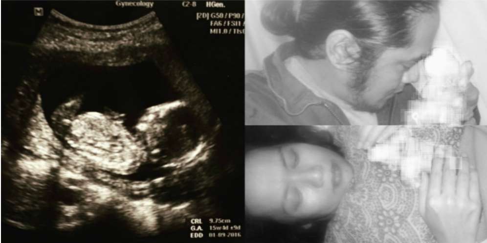 Buah Hati Berpulang, Dea Mirella Tak Kuat Dengar Tangisan Bayi