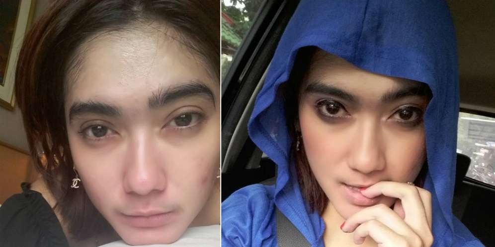 Disebut Pakai Narkoba?