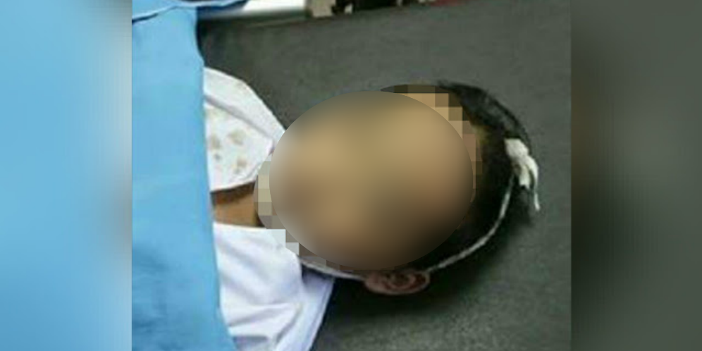 Tewas Dipatuk Ular, Jenazah Bangun Saat Dimandikan, Ternyata..