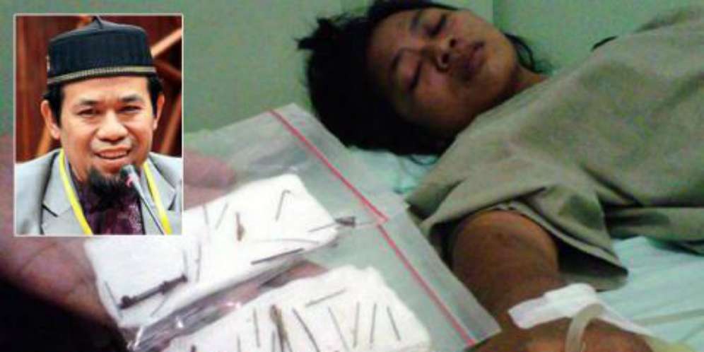 2.000 Paku Misterius Dikeluarkan dari Tubuh Perempuan Sumatra