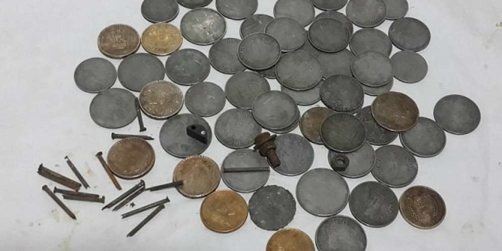 150 Paku dan Uang Logam Ditemukan dalam Perut Pria Ini