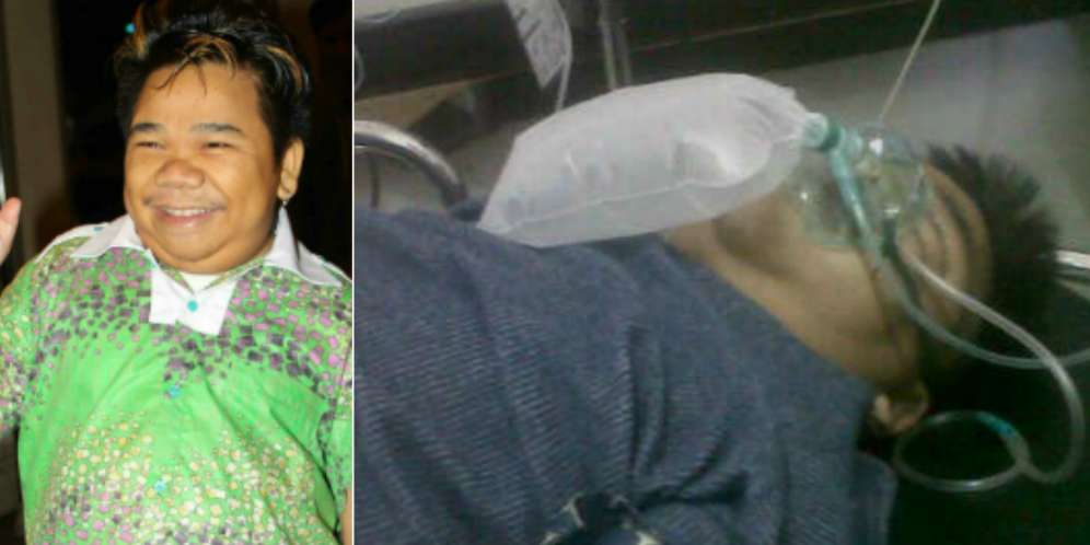 Menyedihkan, Terungkap Cerita Hidup Hendrik Ceper Sebelum Koma
