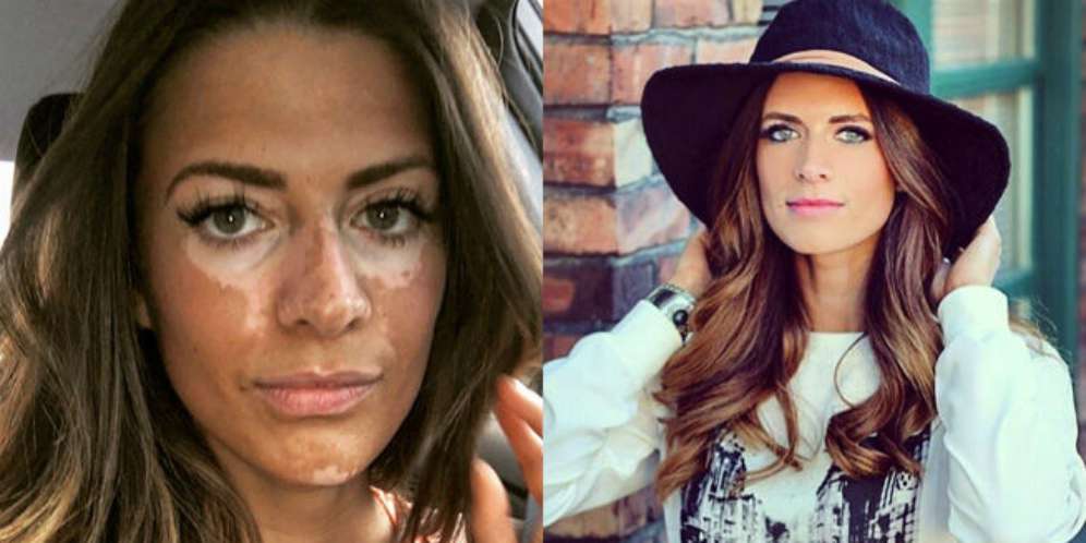 Penyakit Itu Karena...