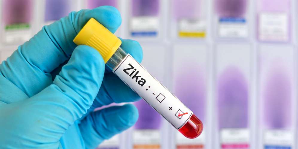 Virus Zika Masuk Indonesia, Ini Ciri-ciri dan Gejalanya