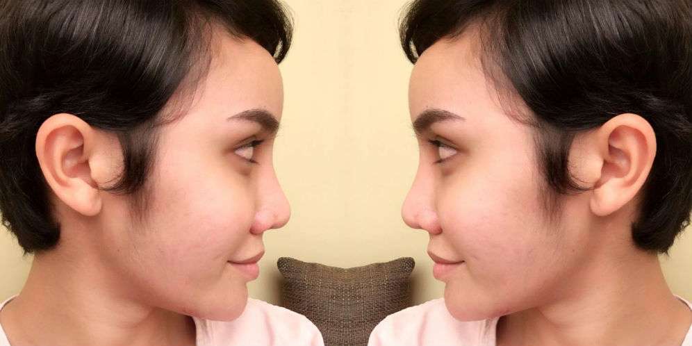 Alasan Berubah Jadi Transgender