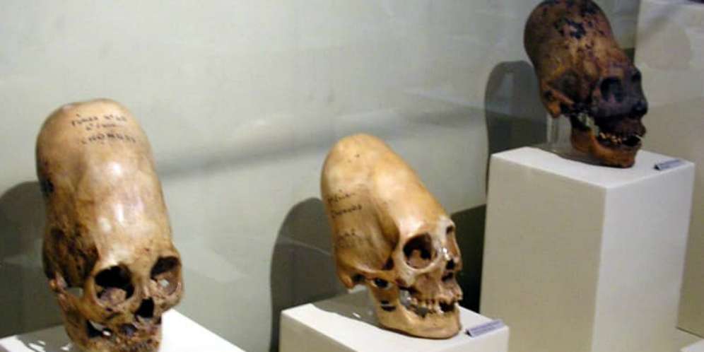 3. Tengkorak Mirip Alien