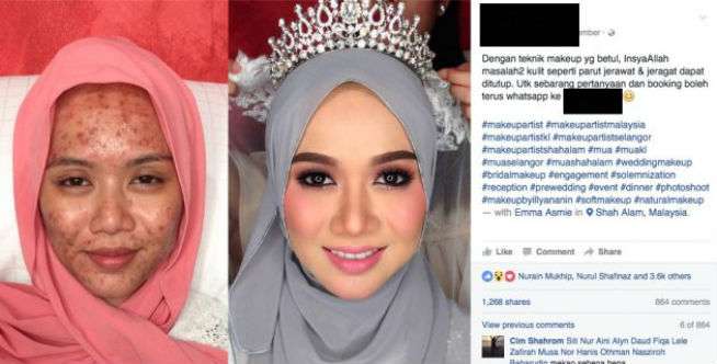 'Dia Sakit Kulit, Tapi Tak Halangi Cinta Saya'