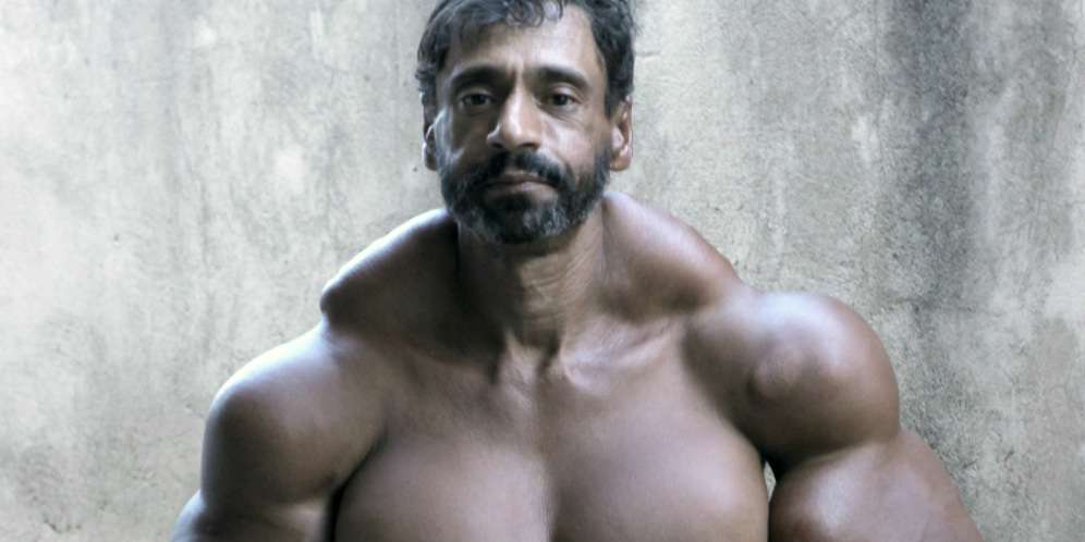 Ngeri! Bisa Diamputasi