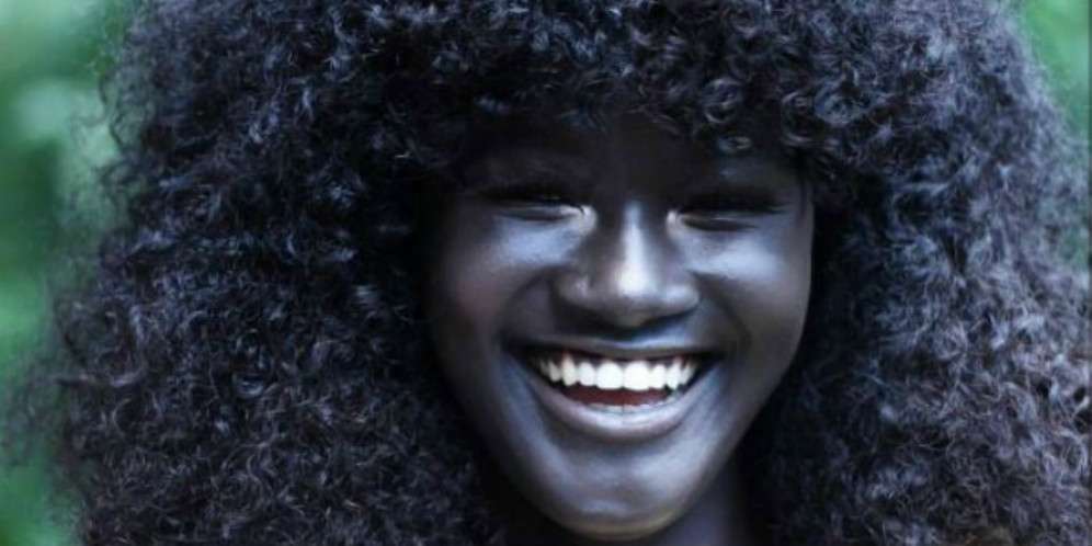 Julukan Menyakitkan Masa Kecil