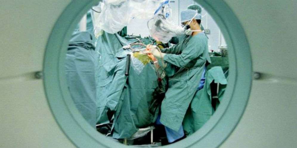 Ada Keanehan Lain