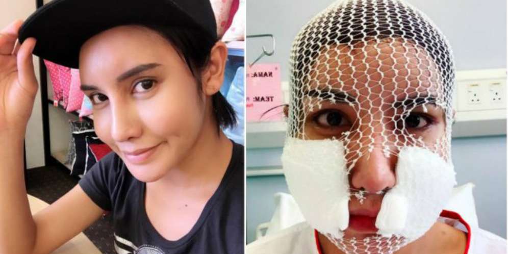 Transgender Angkat Silikon Demi Umroh