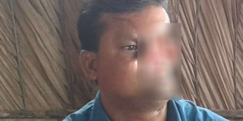 Separuh Wajah Pria Ini Hilang Diterkam Harimau