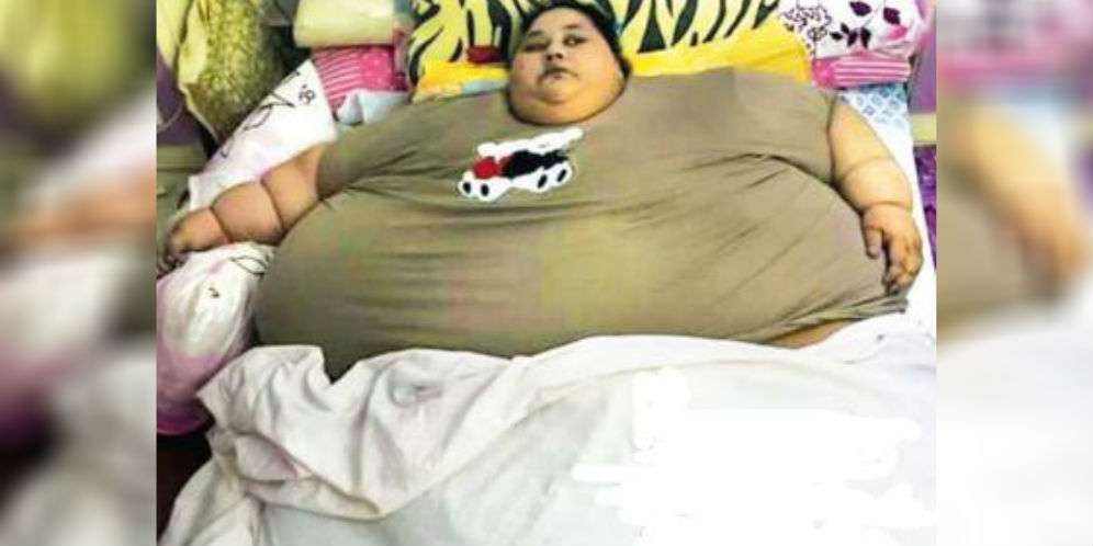 Eman Menderita Banyak Penyakit