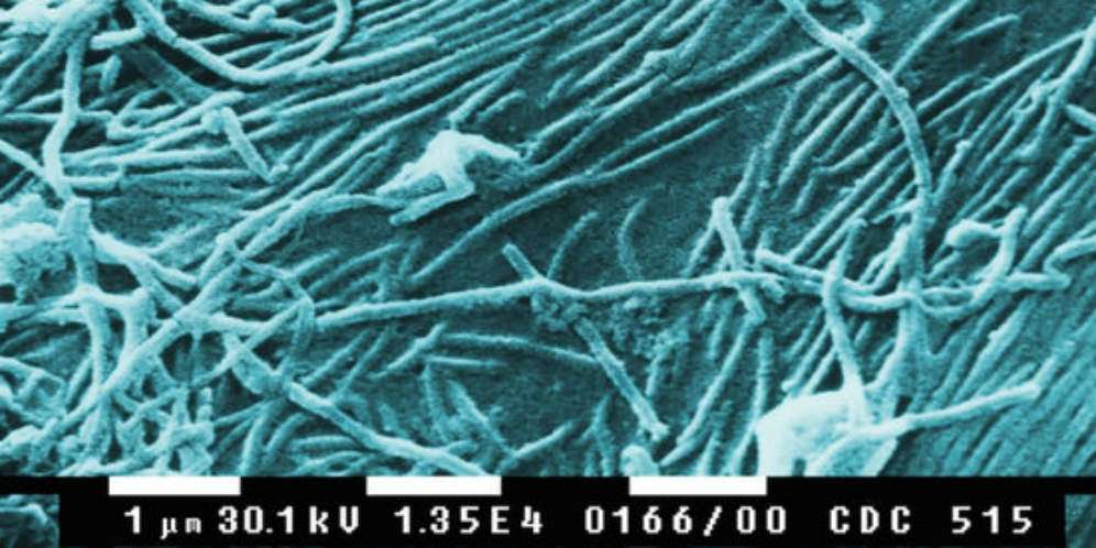 Virus Ebola