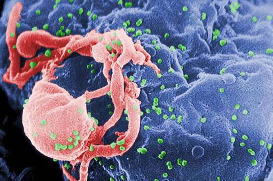 Human Immunodeficiency Virus atau HIV