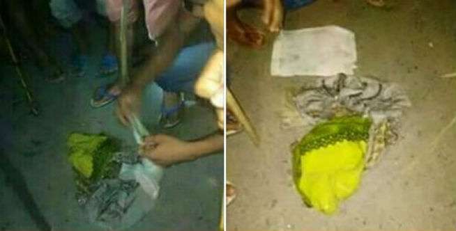 Tubuh Bayinya Miring