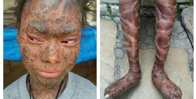 Kaku dan Sulit Bergerak