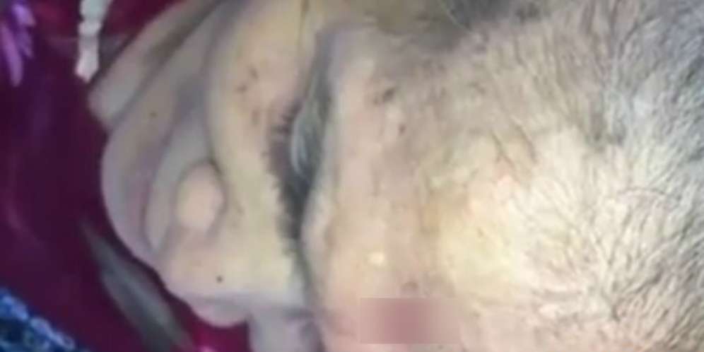 Bau Bangkai dan Muka Jadi Buruk