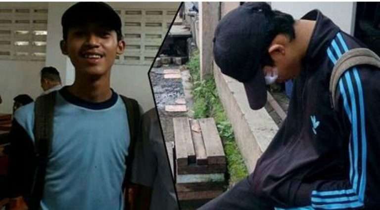 Mata Bengkak dan Keluarkan Nanah
